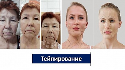 Тейпирование лица и тела